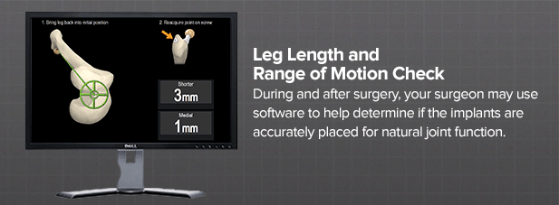leg-length-and-range-of-motion