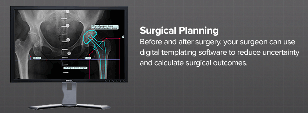 surgical-planning