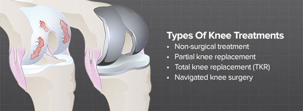what-knee-treatments-are-available