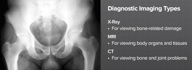 how-are-hip-disorders-diagnosed