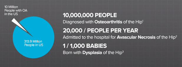 how-common-are-hip-disorders