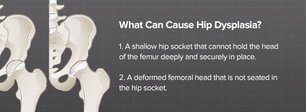 hip dysplasia)