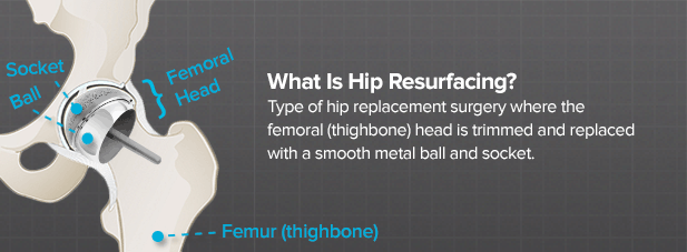 What type of doctor performs hip resurfacing procedures?
