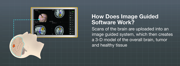 How does image guided software work