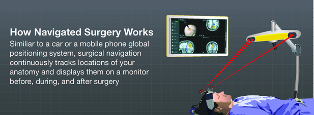 How image guided surgery works