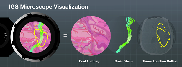 IGS microscope visualization