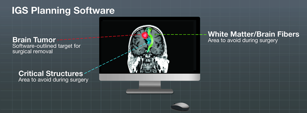 IGS planning software