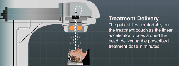 What is Radiation Therapy? - Brainlab.org