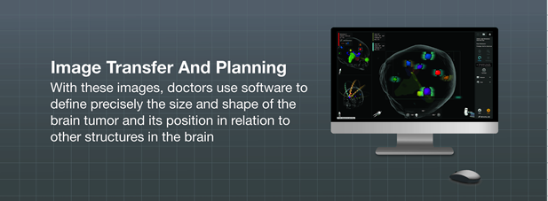 Image transfer and planning