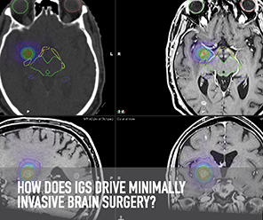 IMAGE GUIDED SURGERY TECHNOLOGY