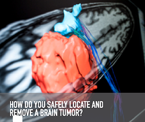 ANATOMICAL AND BRAIN FUNCTION MAPPING