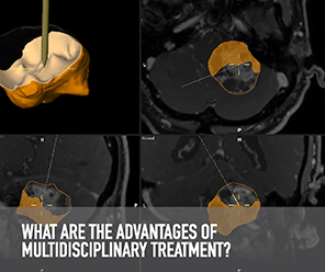 INTEGRATED SURGERY AND RADIATION TREATMENT