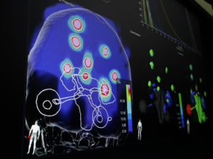 Brain Metastases Treatment