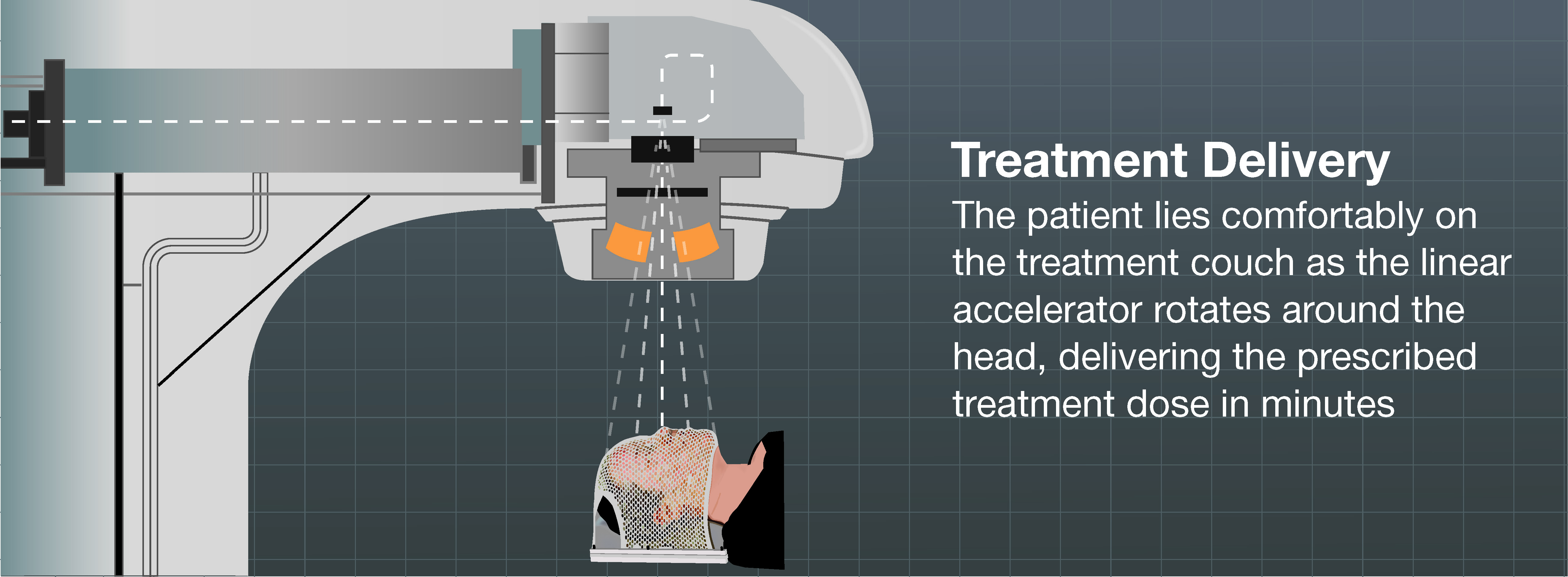 What is Radiation Therapy?