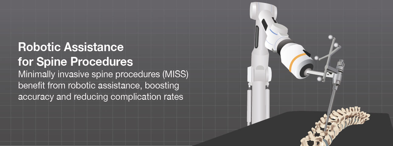 Spine robotic best sale surgery